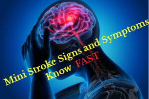 mini stroke signs and symptoms