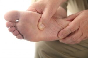 Common Foot Problems in Elderly