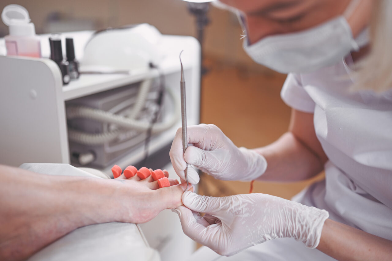 How to Trim Toenails and Fingernails in Elderly? SR Parents