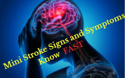 Mini Stroke Signs and Symptoms – Know FAST