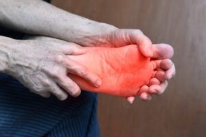 Tingling and Burning Diabetic Feet
