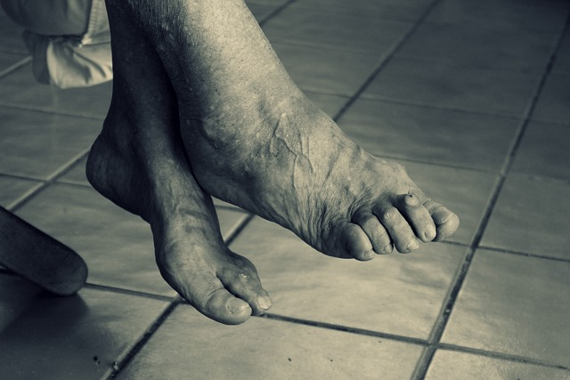 Common Foot Problems in Elderly