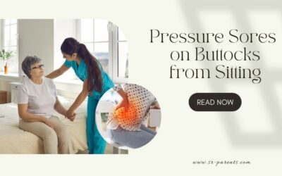 Pressure Sores on Buttocks from Sitting