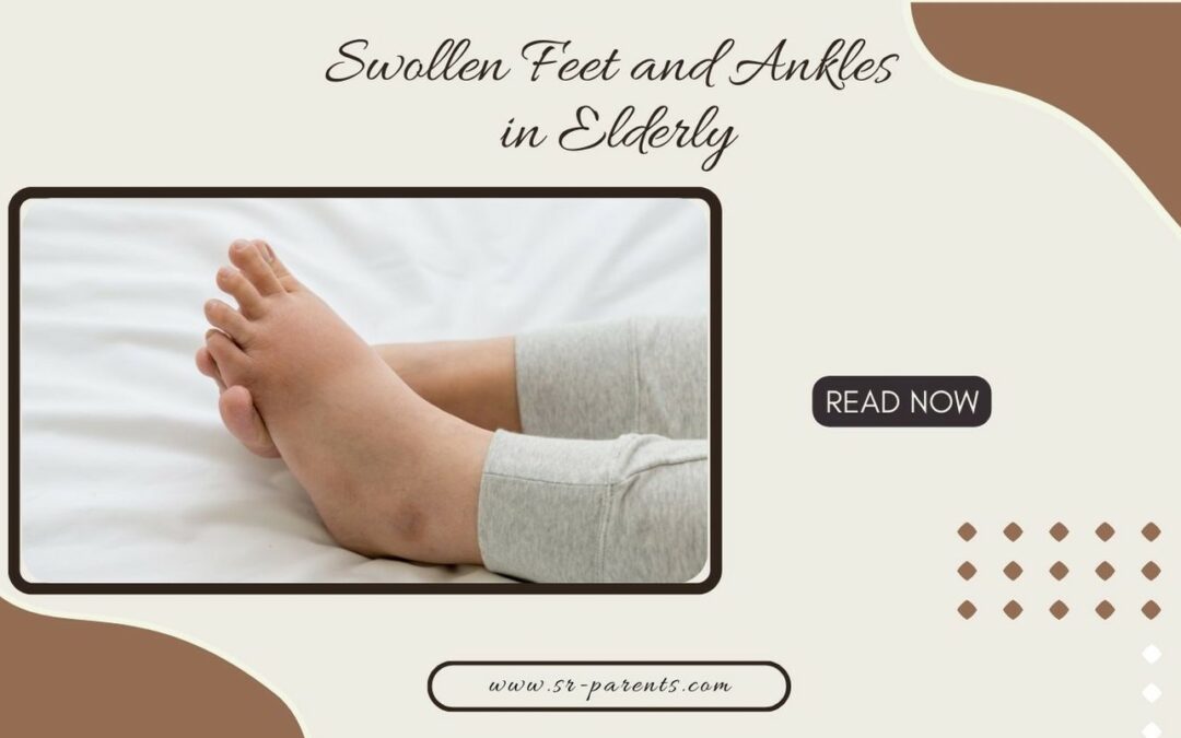 Swollen Feet and Ankles in Elderly
