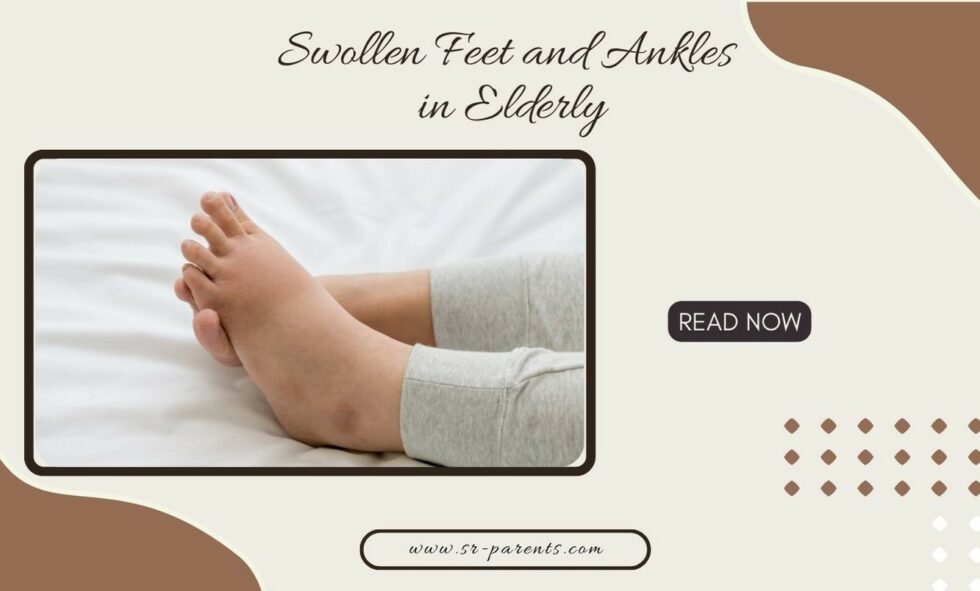 Swollen Feet and Ankles in Elderly SR Parents