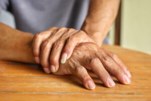 How arthritis affects the feet