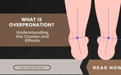 What Is Overpronation? Understanding the Causes and Effects