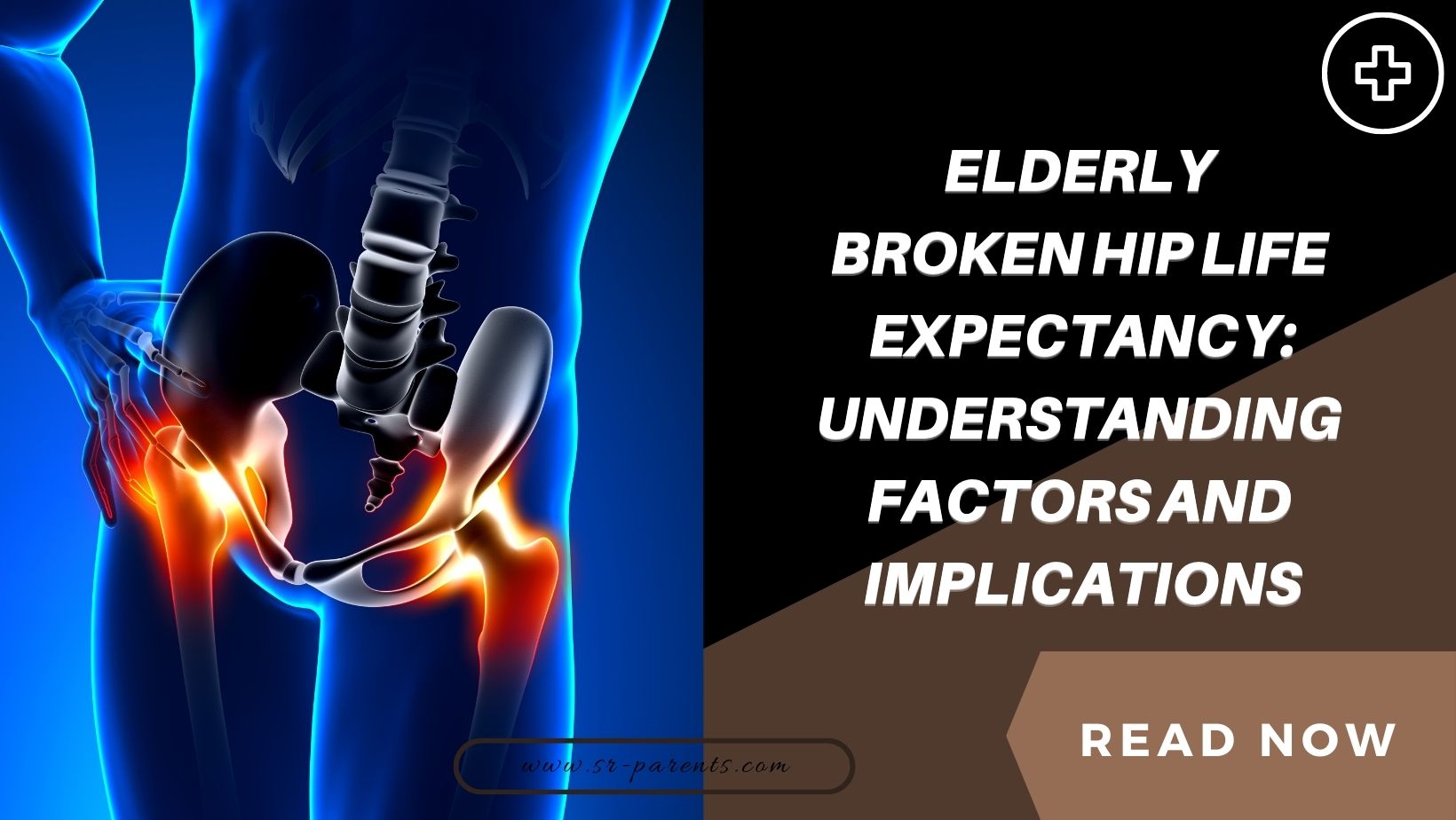 understanding-elderly-broken-hip-life-expectancy