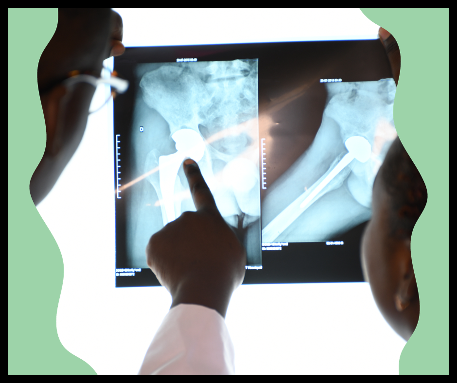 how is osteoporosis diagnose, osteoporosis in elderly