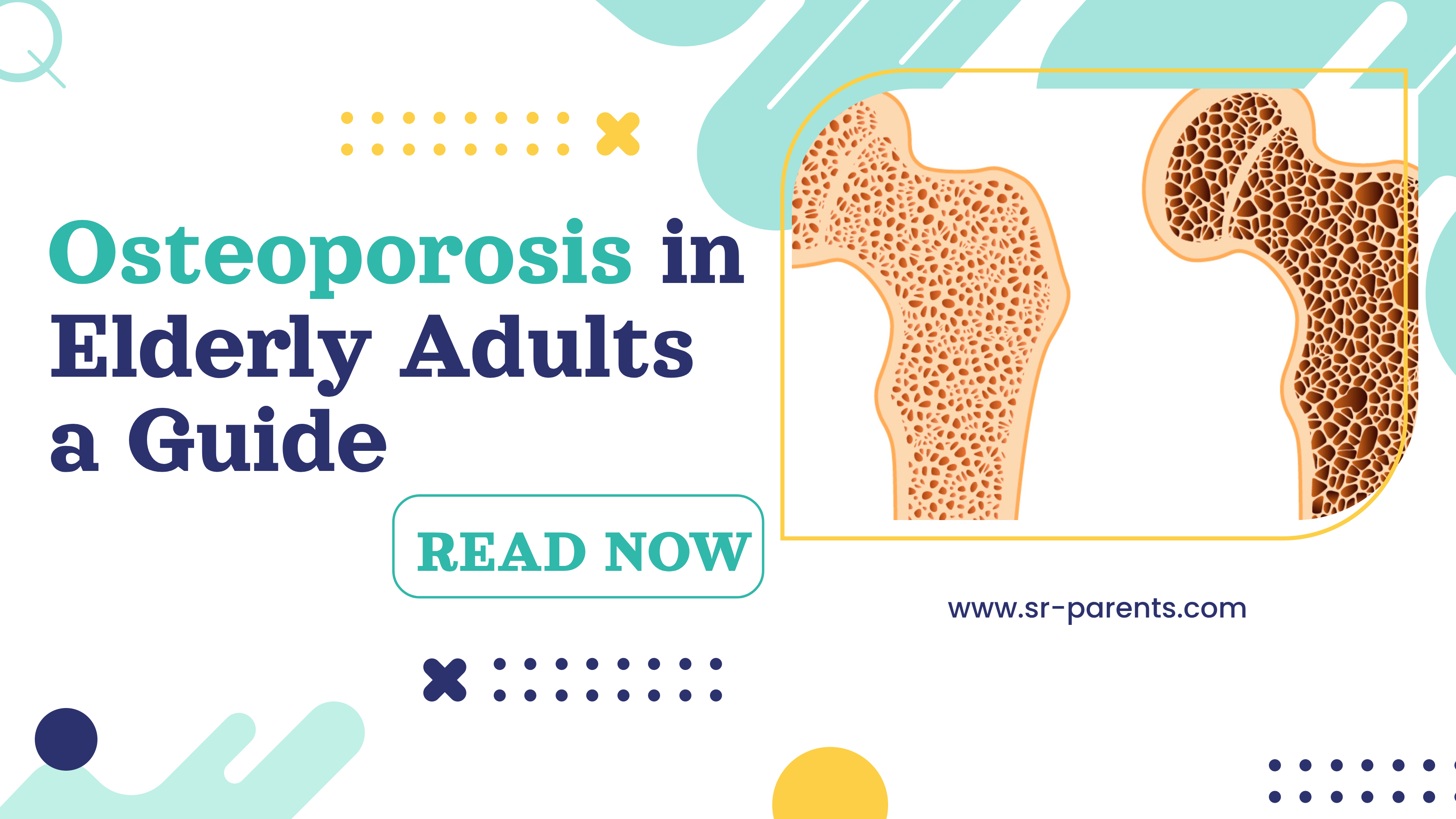 Osteoporosis in Elderly Adults a Guide - SR Parents
