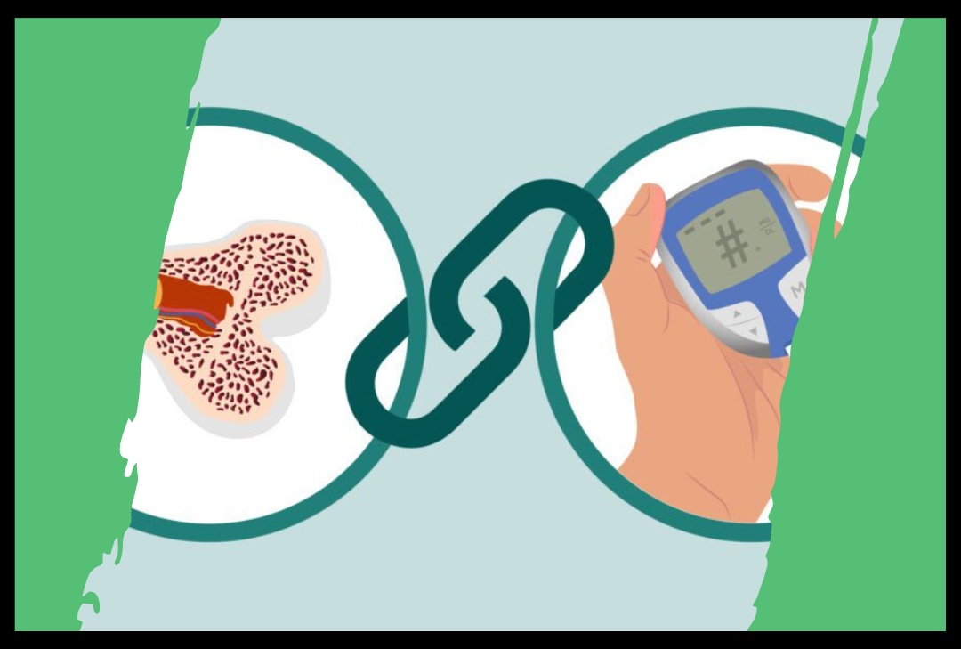 The Link Between Type 2 Diabetes and Osteoporosis